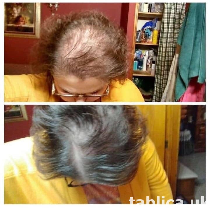 hair treatment 1