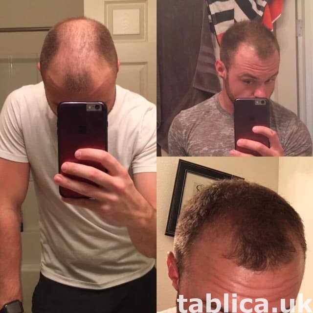 hair treatment 2