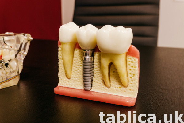 Brighten Your Smile with Our teeth whitening options  1